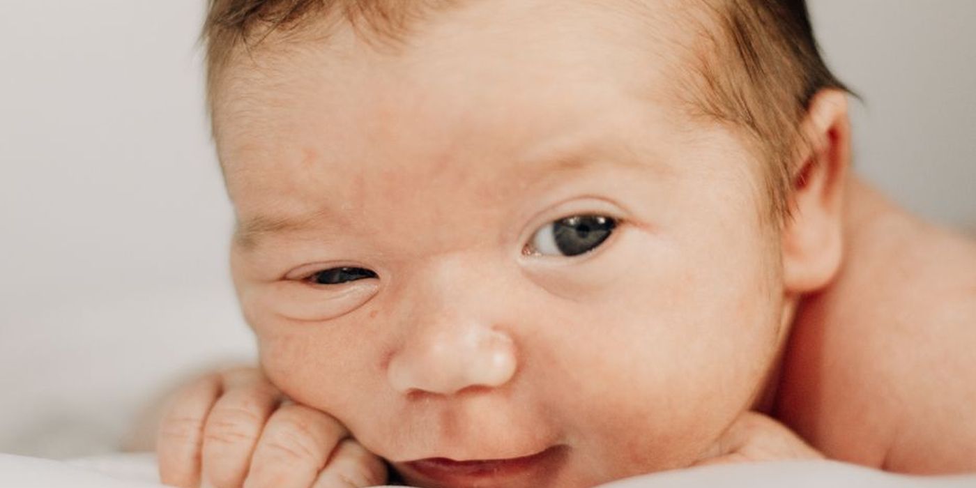 Bayi baru lahir dengan rambut halus