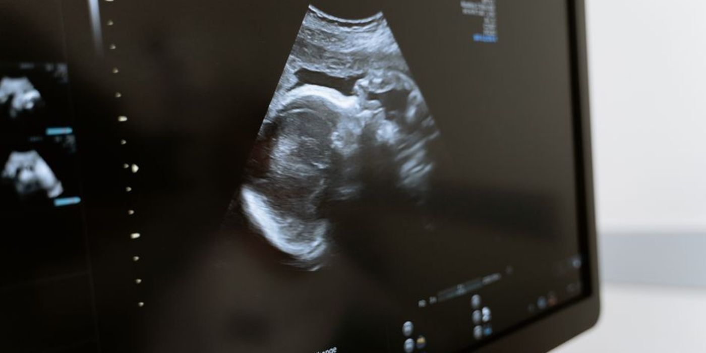 Imbasan ultrasound kandungan