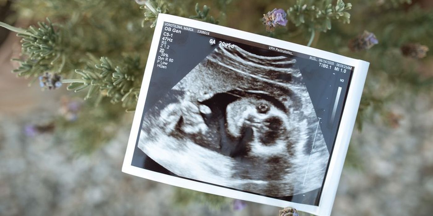 Gambar imbasan ultrasound bayi
